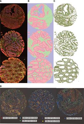 Activated tissue resident memory T-cells (CD8+CD103+ - Frontiers